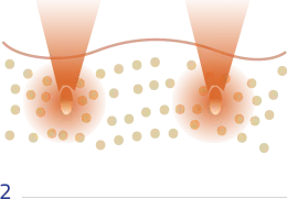 Skin Shifting02