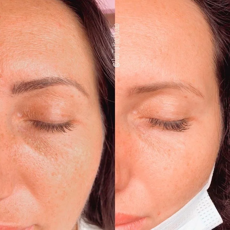 Уход за лицом: hydradermie, увлажнение