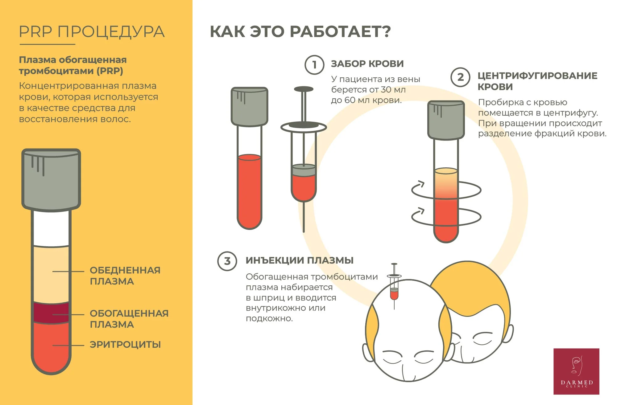 Prp для волос отзывы. Пробирки песочные часы для PRP. Процедура РRP.